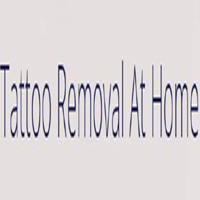 IPL Tattoo Removal Coupon Codes
